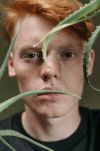 How to Use Aloe Vera to Treat Acne and Skin